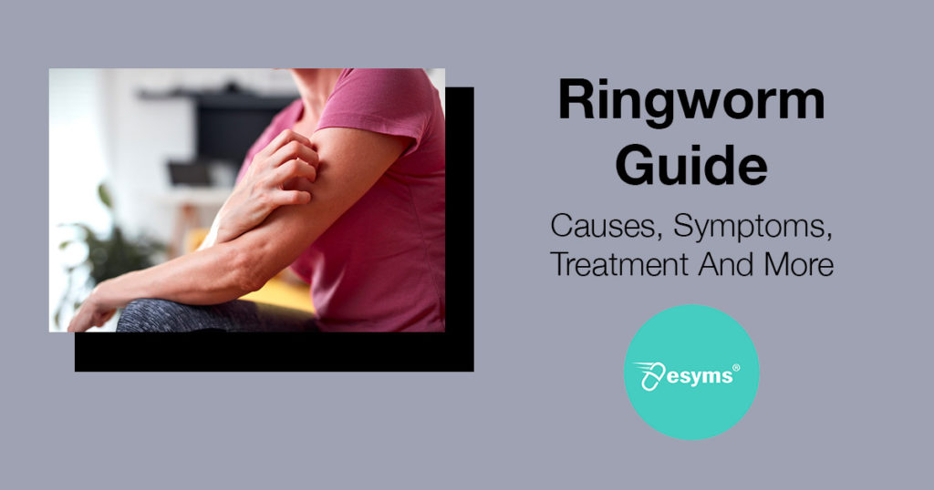ringworm guide